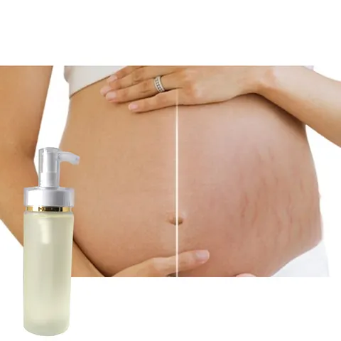 Organic Scar and Stretch Mark Repair Oil is used on skin to retract wrinkles, bid goodbye to scars and regain firmness